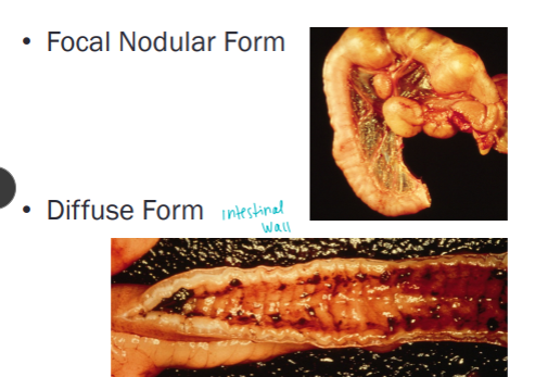 <p>Intestinal Lymphoma</p>