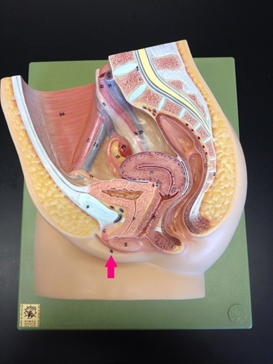 <p>Homologous to the scrotum</p><p>Paired</p><p>Run inferiorly and posteriorly from the mons pubis</p><p>Pigmented and hair-covered skin folds</p>
