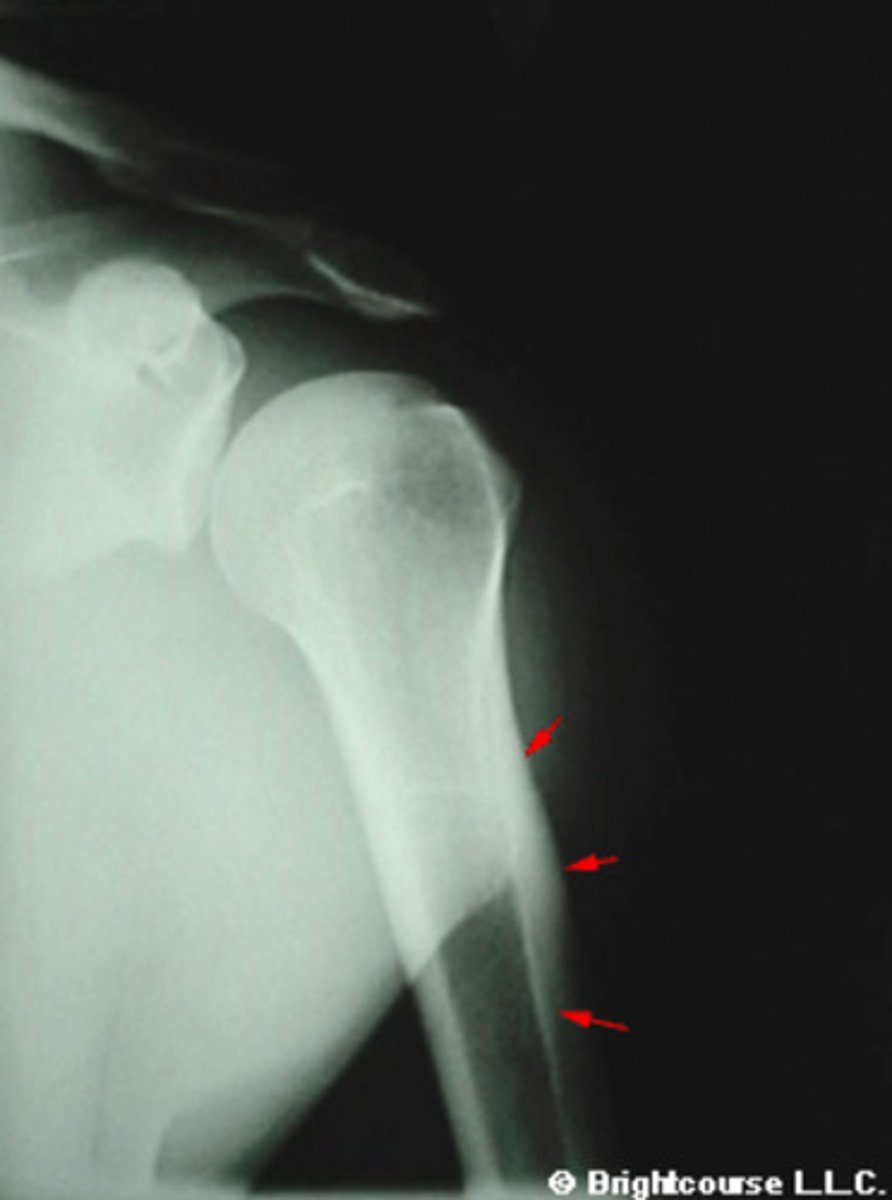 <p>What is being pointed out by the arrows in the image?</p>