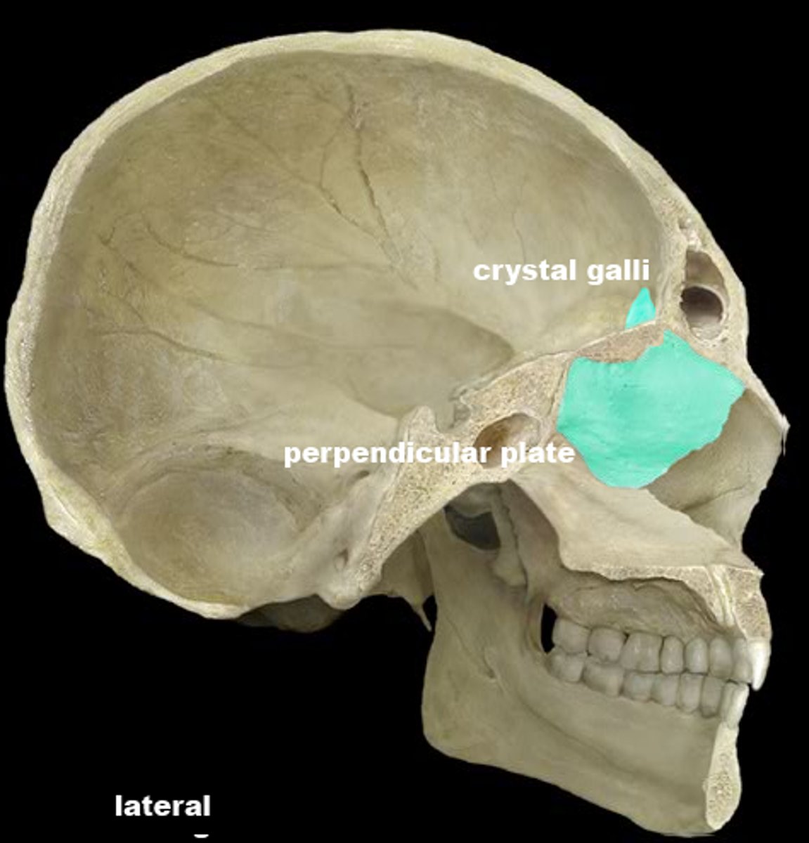 <p>these are features of which bone?</p>