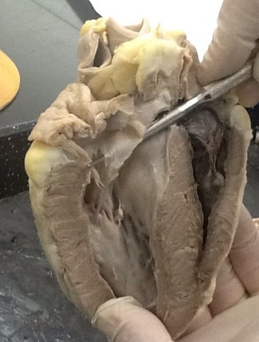 <p>Identify this valve: NOTE, posterior view</p>