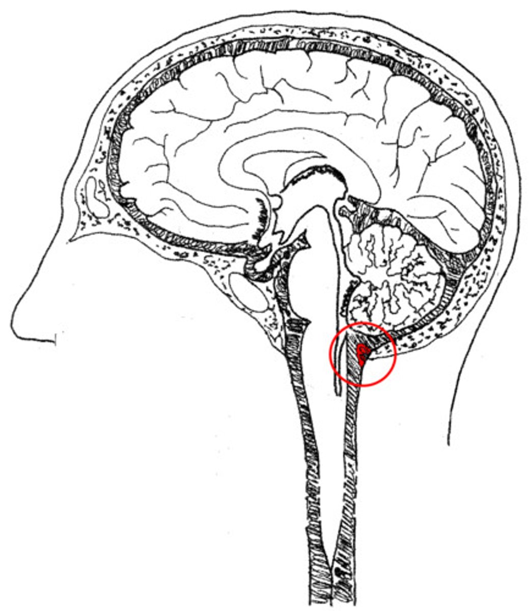 <p>cistern found between the cerebellum and medulla</p>
