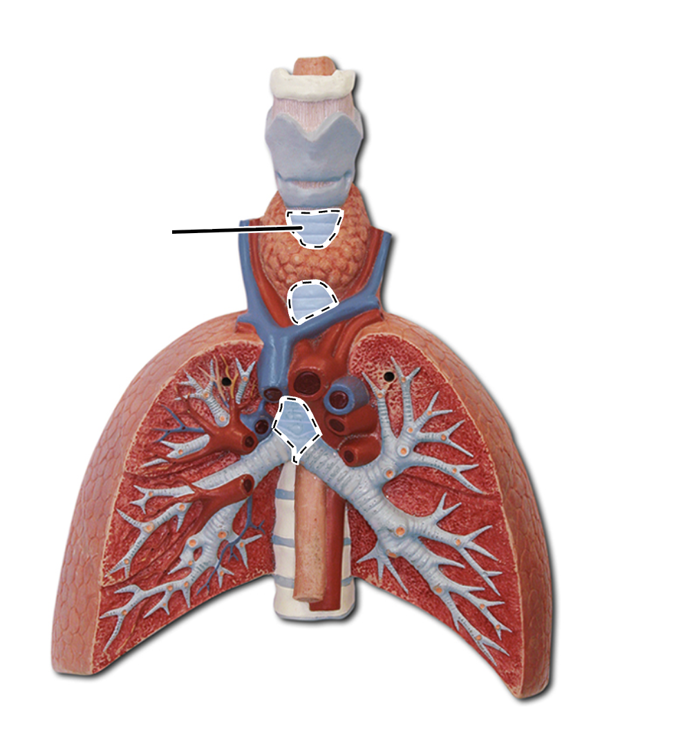 <p>What is this?</p>