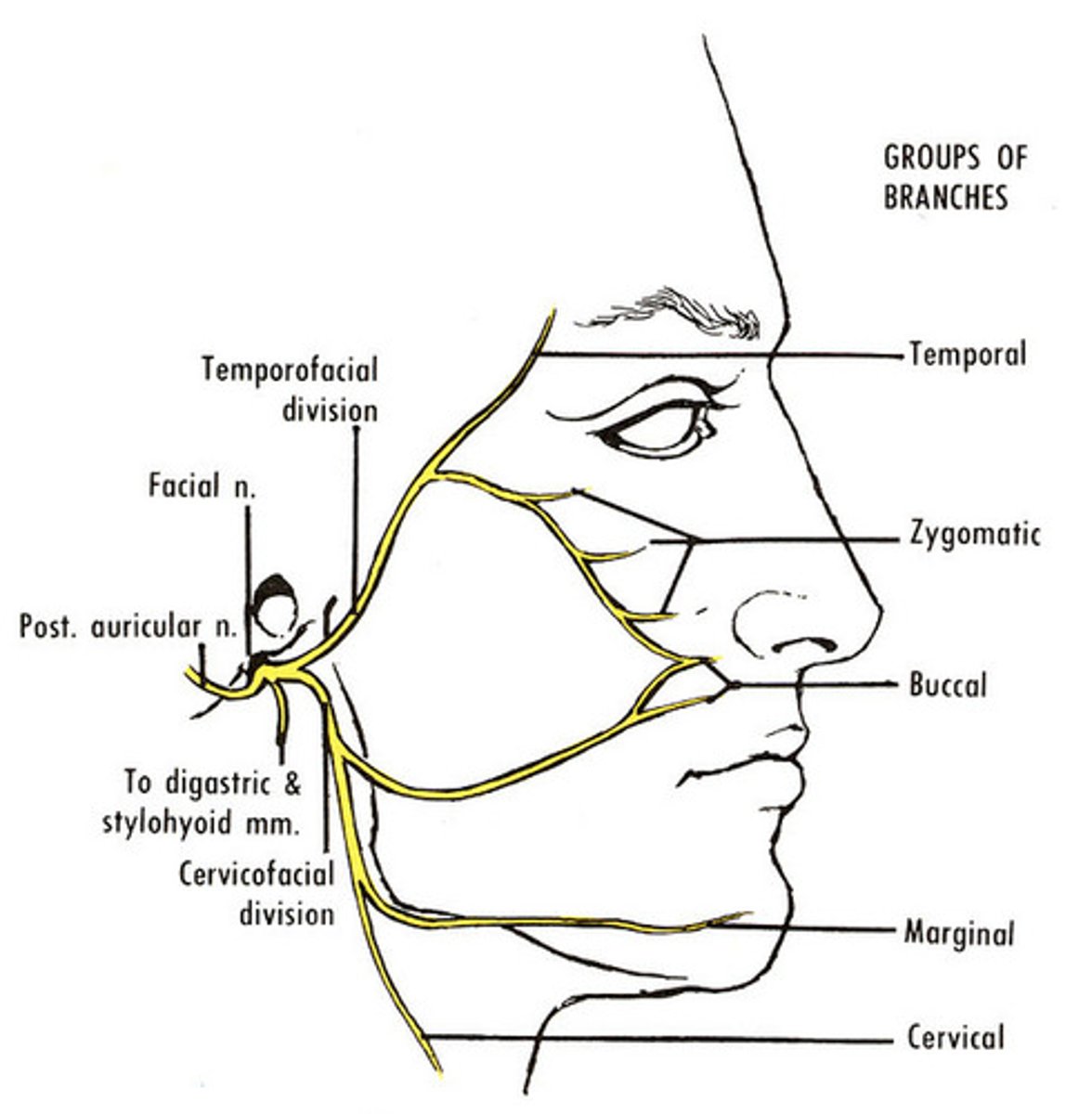 <p>facial nerve (CN VII)</p>