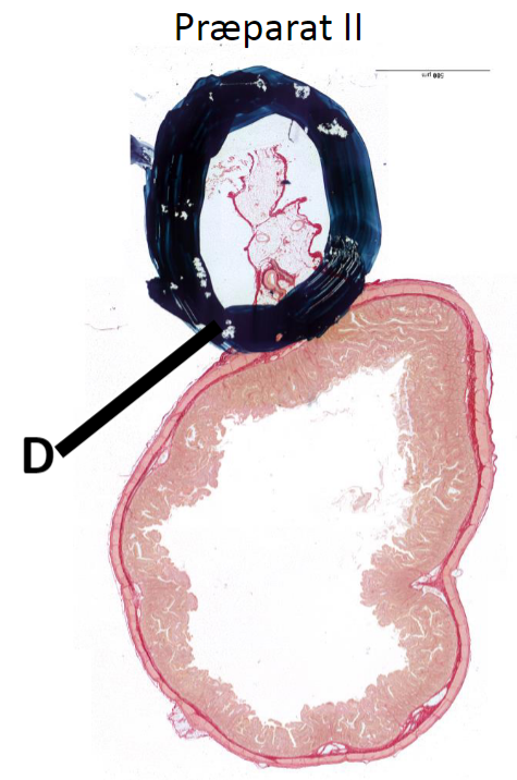 <p><strong>Post 5.</strong></p><p><u>Præparat II</u></p><p></p><p><strong>Spørgsmål 4:</strong> Hvilket organ stammer præparatet fra?</p>