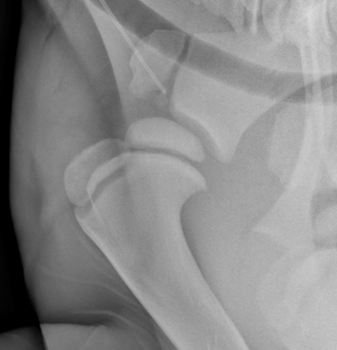 <p>What can you assume about the age of this horse?</p>