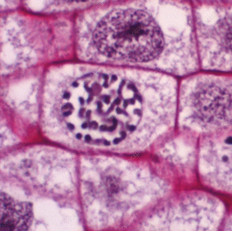 <p>what stage of the cell cycle is being showed here ?</p>