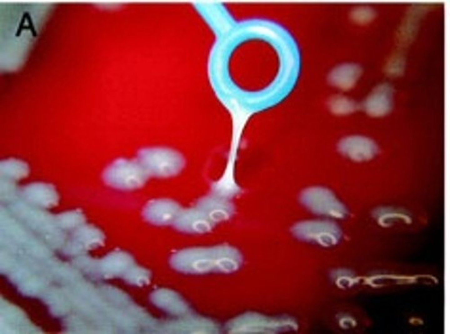 <p>-Hypermucoviscous phenotype (HMV)</p><p>-has been associated with virulence determinates for capsular phenotypes K1 and K2</p>