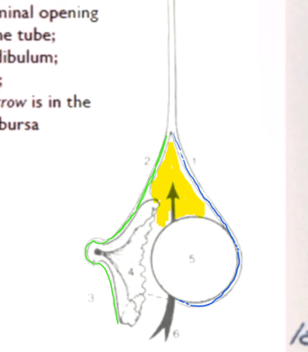 <p>A space (yellow) whose walls consists of the mesovarium (blue) and the mesosalpinx (green)</p>