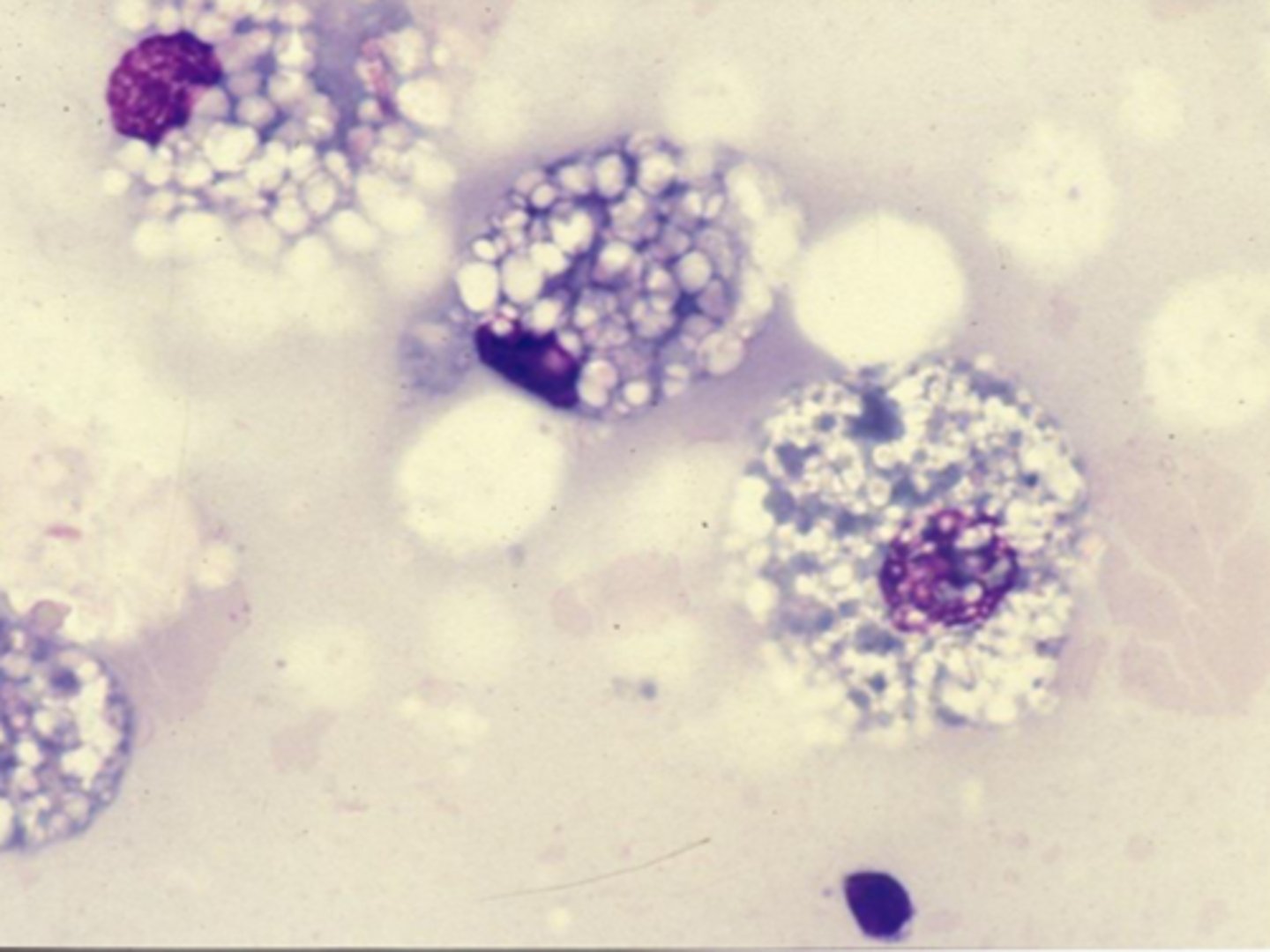 <p>What are examples of degenerative lesions?</p>