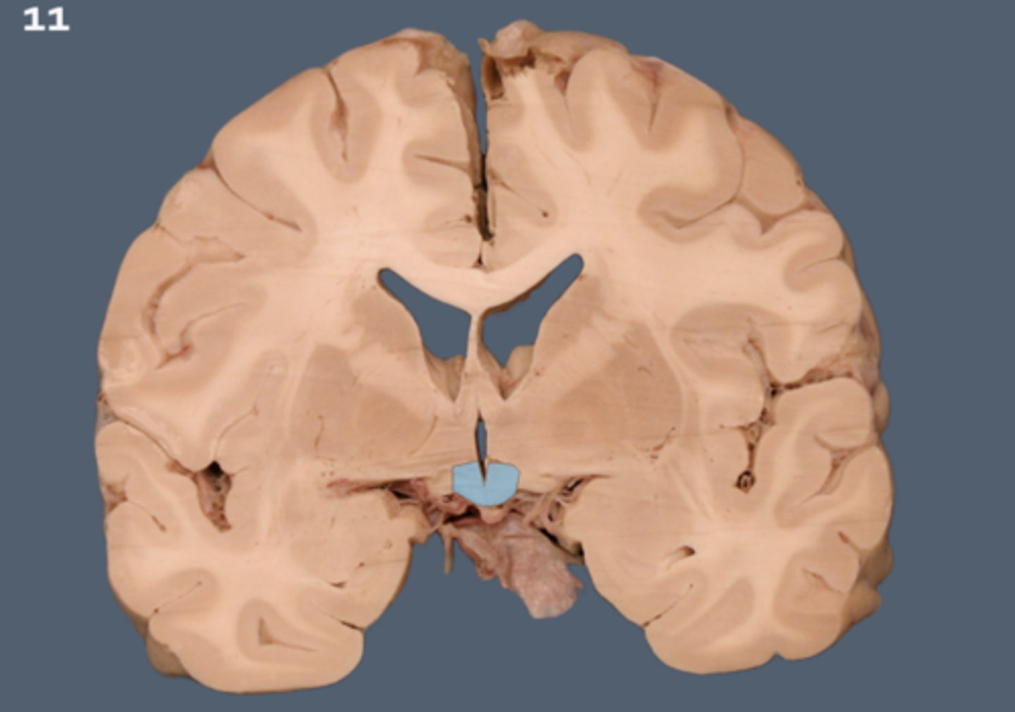 <p>anterior+inferior to the thalamus, U-shape below the third ventricle, medial to globus pallidus. maintains homeostasis.</p>