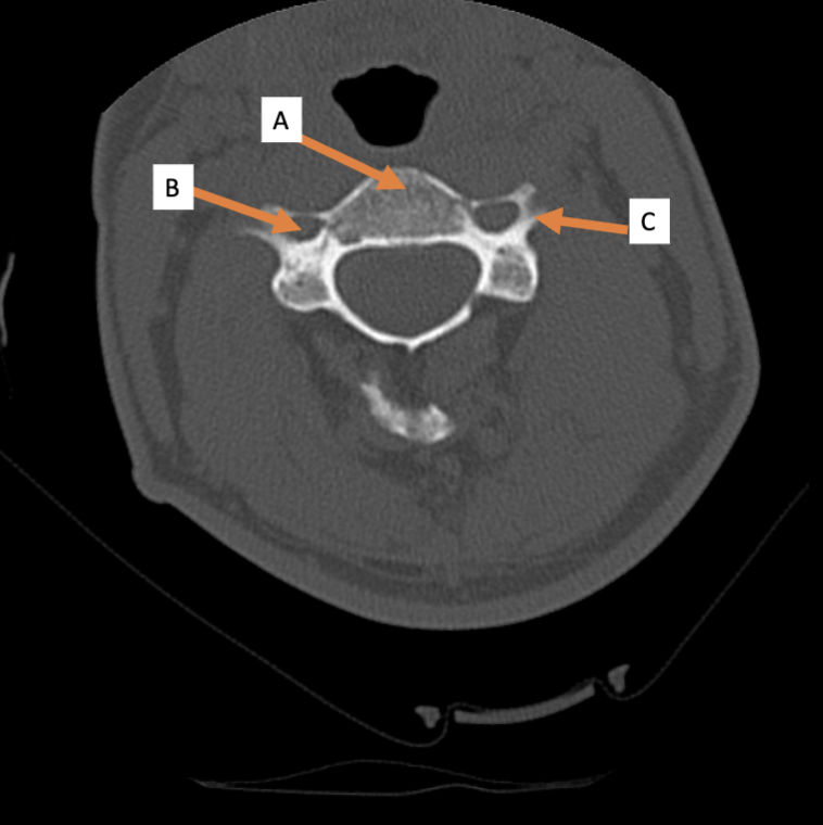<p>C. Identify structure</p>