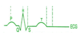 <p>what does the T wave indicate on an EKG?</p>