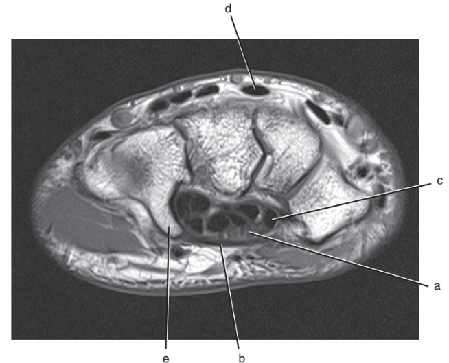 <p>What is letter e ?</p>