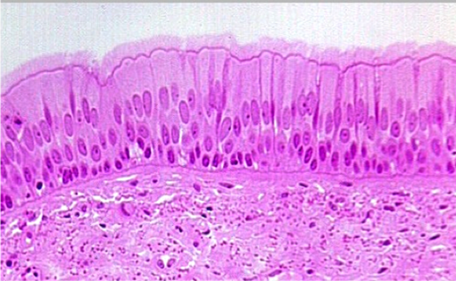 <p>Pseudostratified columnar epithelium</p>