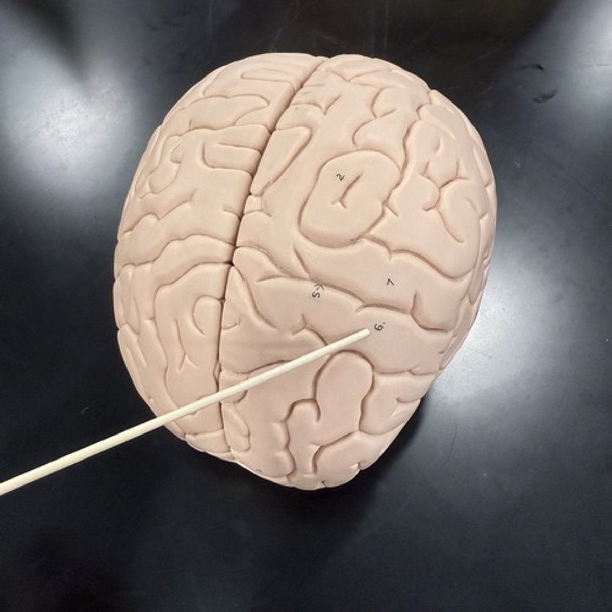 <p>What is this ridge (fold)?</p>