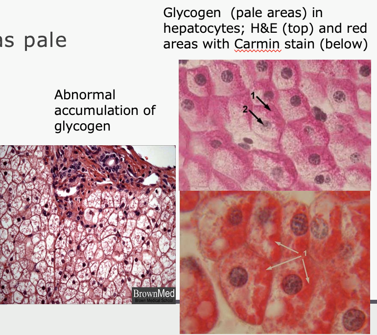 <p>storage form of glucose</p><ul><li><p>not stained by H&amp;E (appears as pale areas or vacuoles)</p></li><li><p>stains for glycogen</p><ul><li><p>Carmin (red) - specific for glycogen</p></li><li><p>PAS (pink) - <strong>stains all carbohydrates</strong></p></li></ul></li></ul><p></p>