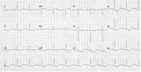 <p>What does this indicate</p>