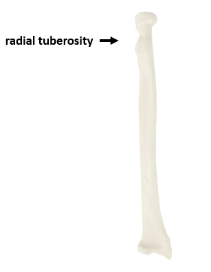 <p>What bone is this?</p>