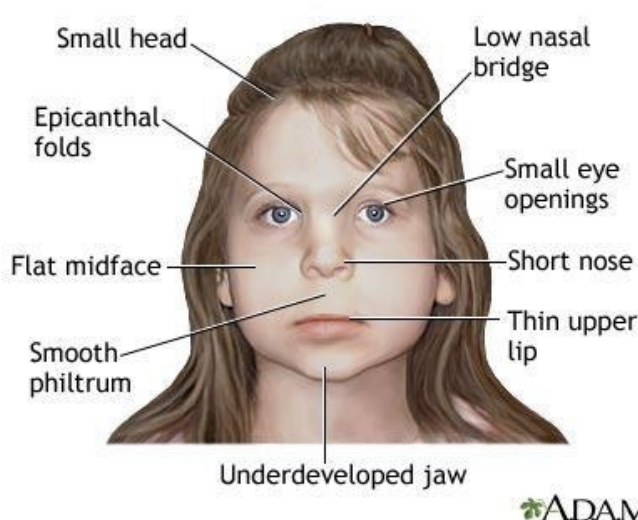 <p>Teratogens</p><p>___________ - Can adversely affect ovum prior to fertilization</p><ul><li><p>Fetal Alcohol Syndrome (FAS): group of conditions with Fetal Alcohol Spectrum Disorder (FASD) being the most severe</p></li></ul><p></p>