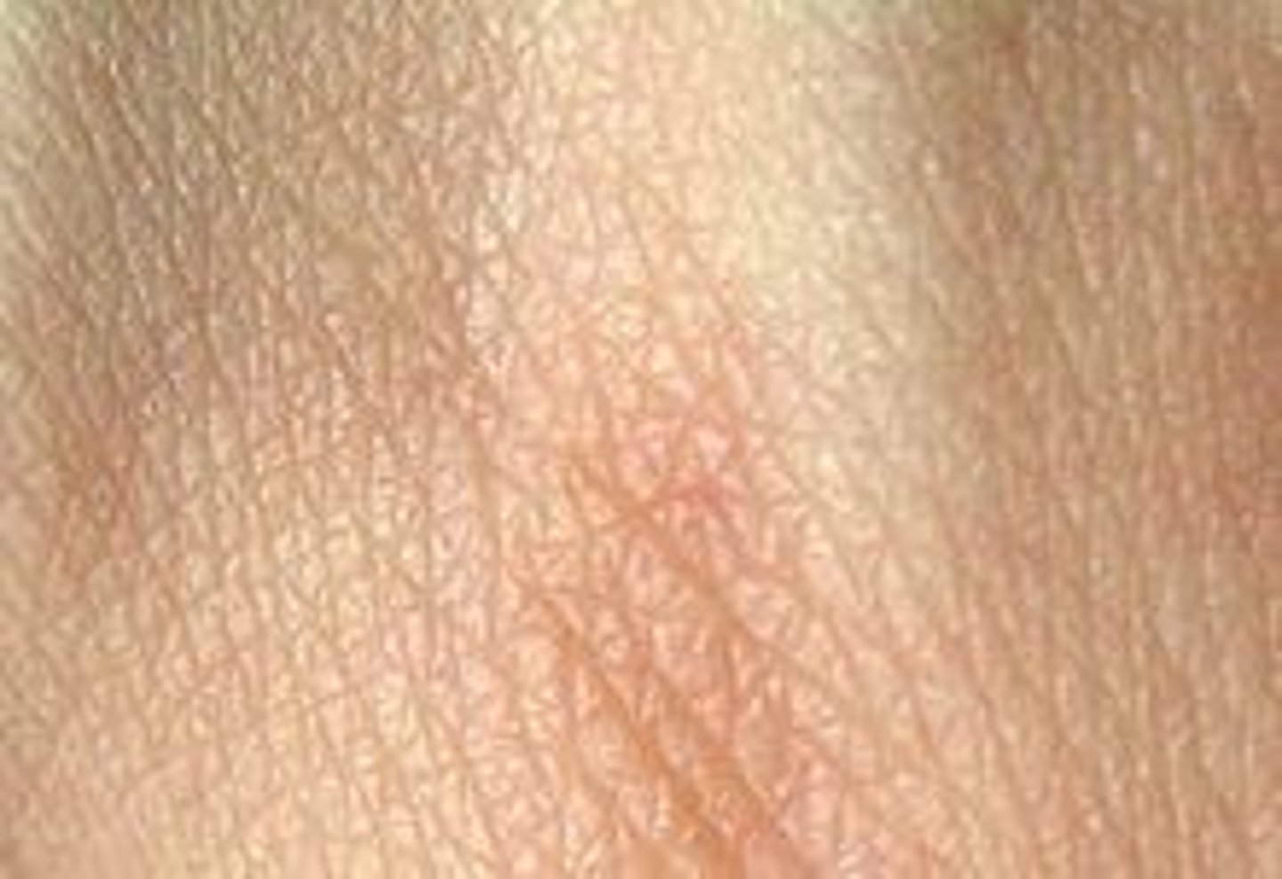 <p>penyakit kulit</p>