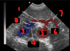 <p>Label the crossed-out structures on this image.&nbsp;</p>