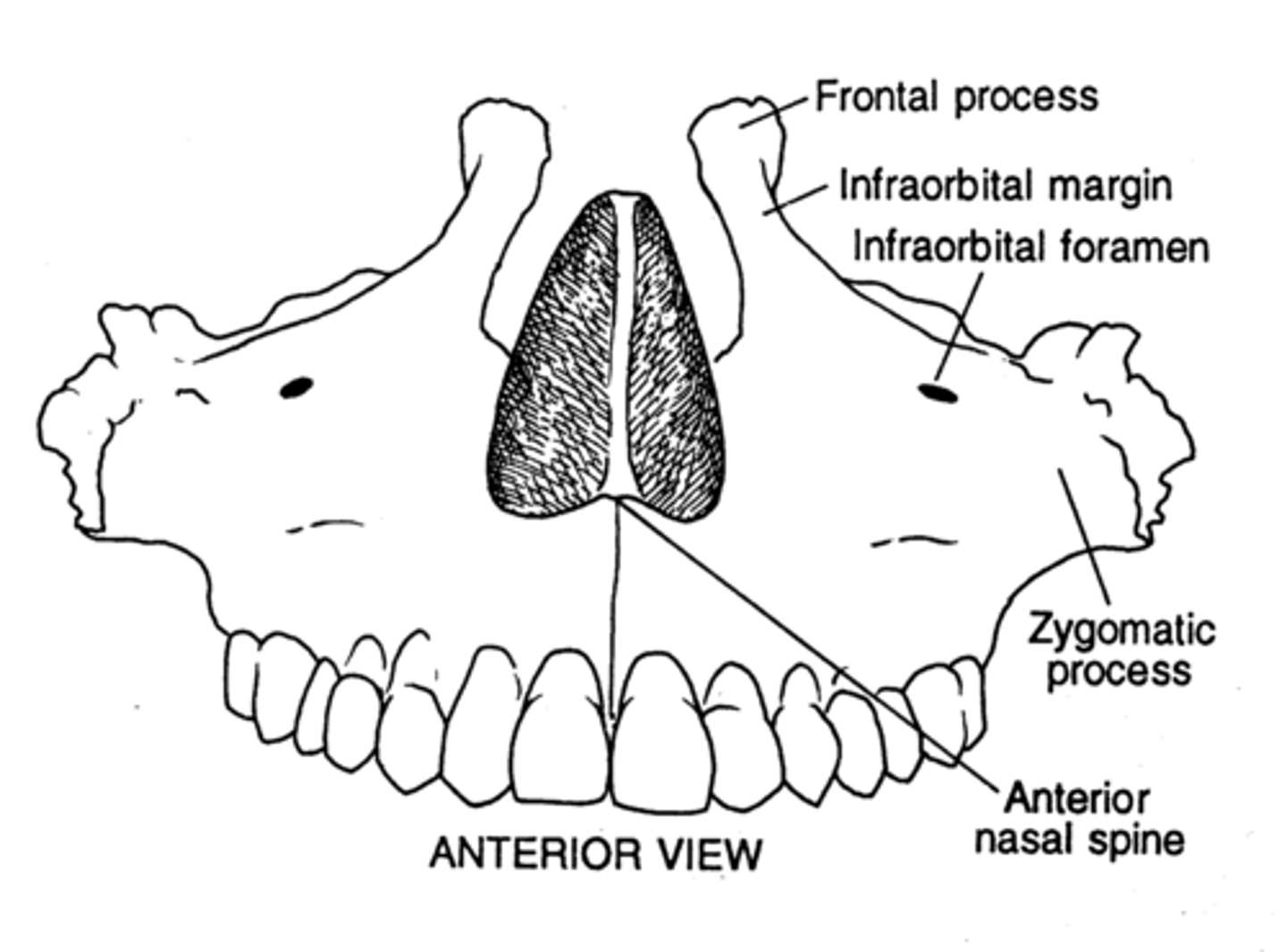 <p>Infraorbital foramen - Maxillary sinus</p>