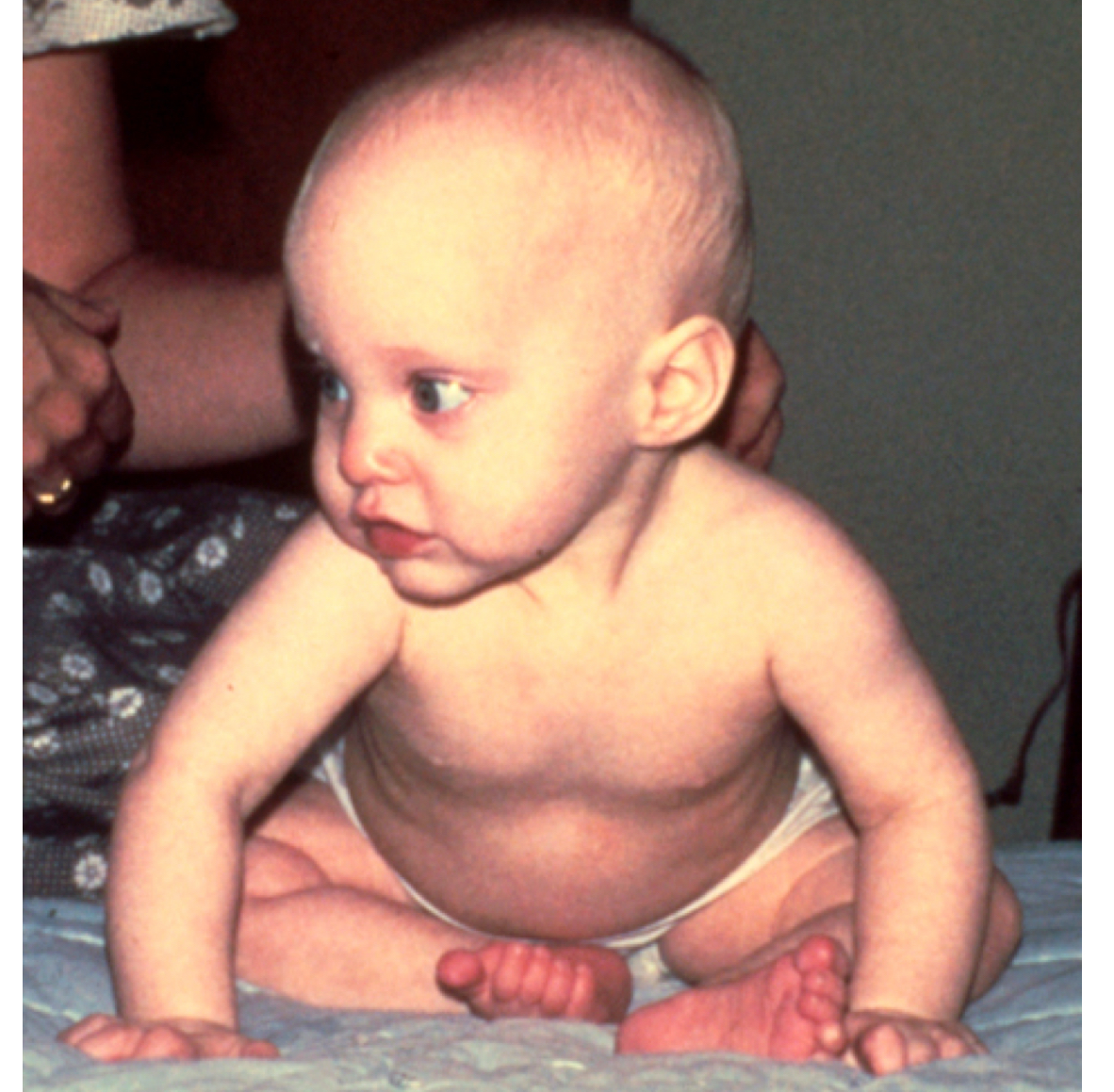 <p>what quarter of life is this infant demonstrating?</p>