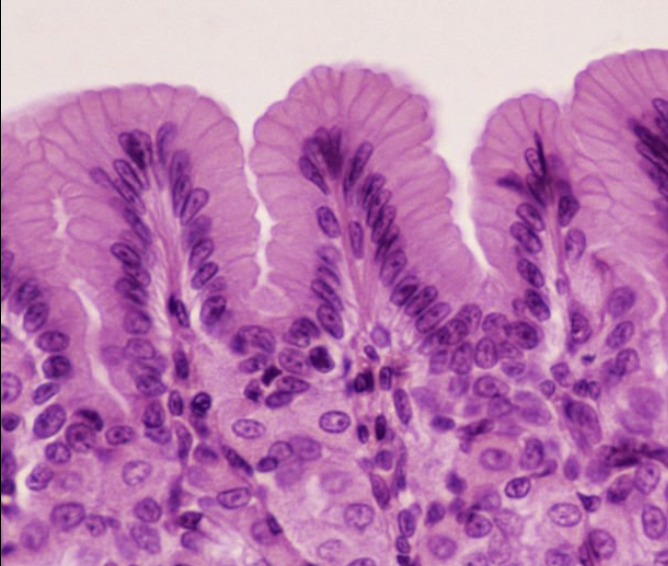 <p>simple columnar epithelium</p>