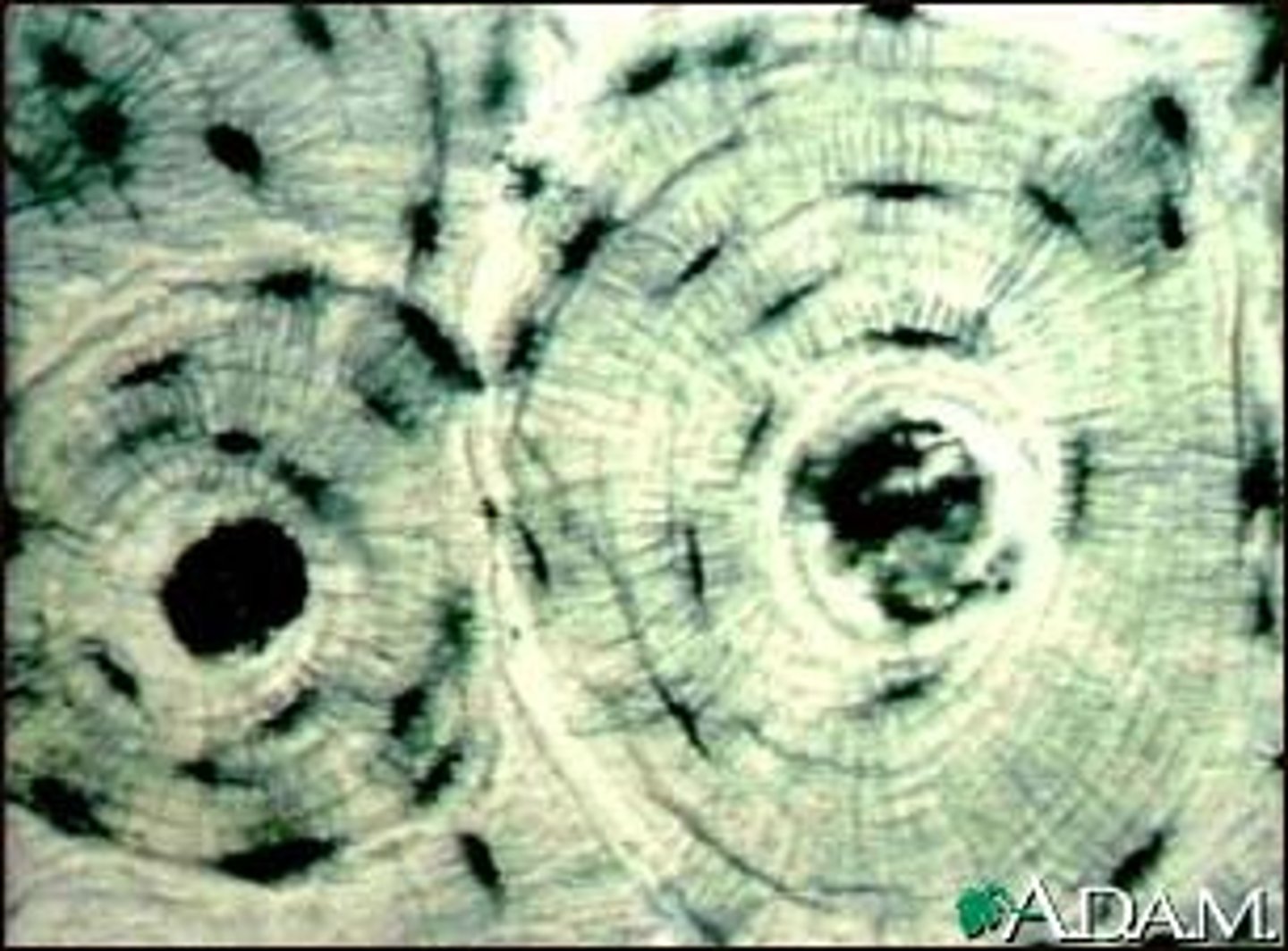 <p>-lacunae</p><p>-canaliculi</p><p>-calcified matrix arraged in concentric lamellae of osteon</p><p>-osteon</p>