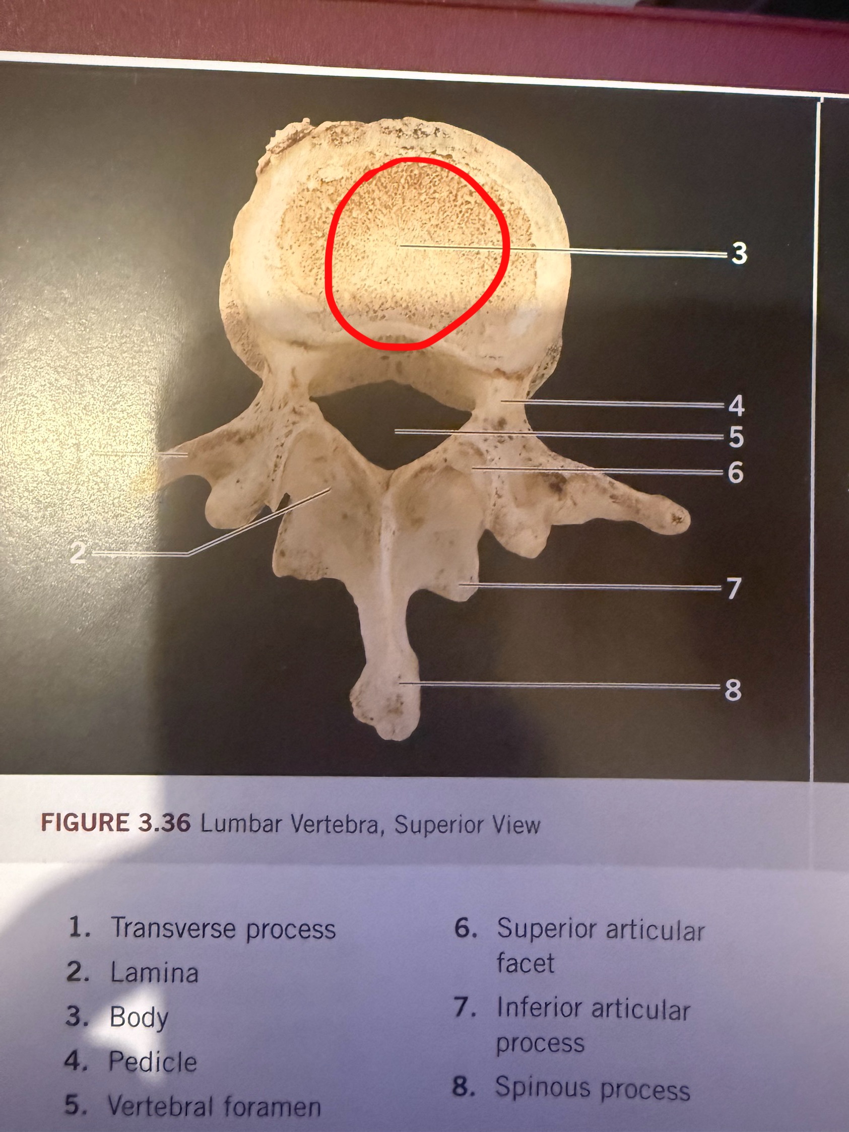 term image