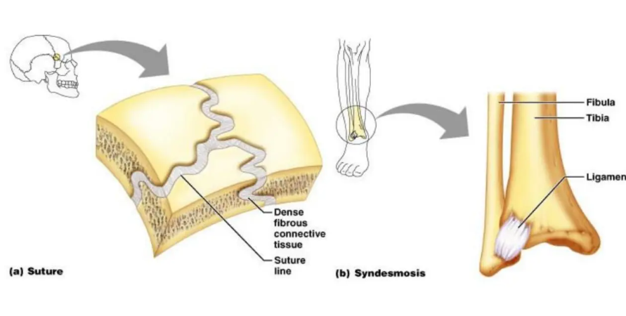 bones joined by dense connective tissue

* joints are relatively rigid and do not allow for very much motion (if any at all).

Example – sutures (connecting bones of the skull)