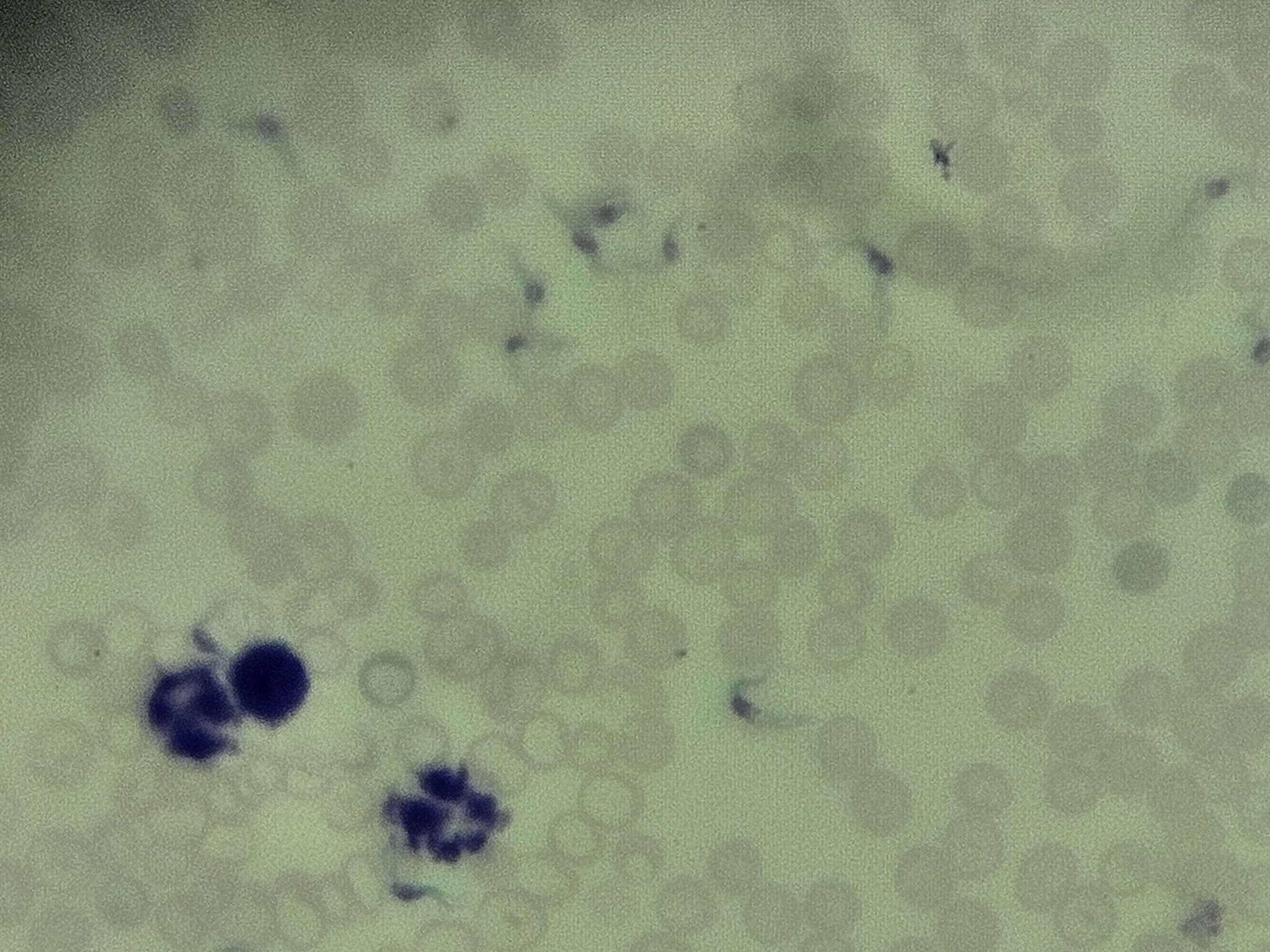 <p><span data-name="microscope" data-type="emoji">🔬</span><span data-name="petri_dish" data-type="emoji">🧫</span><strong><span> </span>Na podstawie zdjęcia preparatu:</strong></p><p></p><ul><li><p><span data-name="book" data-type="emoji">📖</span><span> </span>rozpoznaj gatunek pasożyta;</p></li></ul><p></p><ul><li><p><span data-name="recycle" data-type="emoji">♻</span><span> </span>rozpoznaj wszystkie formy rozwojowe;</p></li></ul><p></p><ul><li><p><span data-name="microbe" data-type="emoji">🦠</span><span> </span>wskaż organelle i cechy charakterystyczne dla danego gatunku;</p></li></ul><p></p><ul><li><p><span data-name="mask" data-type="emoji">😷</span><span> </span>nazwij chorobę, którą pasożyt wywołuje.</p></li></ul><p></p>