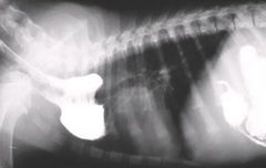 <p>What is this condition called? It can cause stenosis (stricture) of the esophagus at the area of the heart</p>