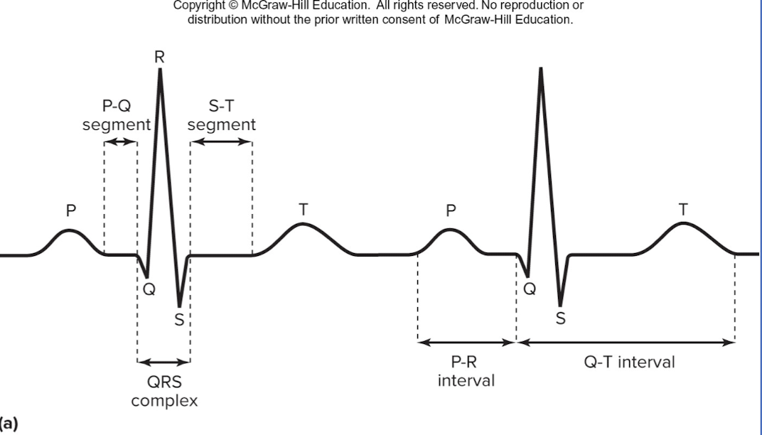 <p>QRS complex</p>