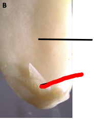 <p>What is depicted here in this bean seed with the coat removed?</p>