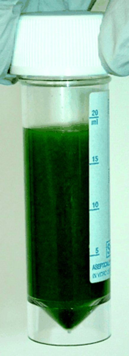 <p>A mixture of salts and phospholipids that aids in the breakdown of fat</p>