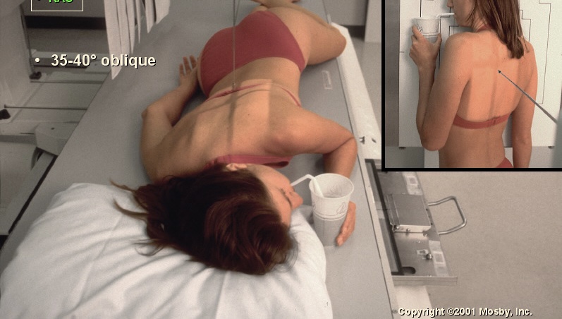 <p>What position is this?</p>