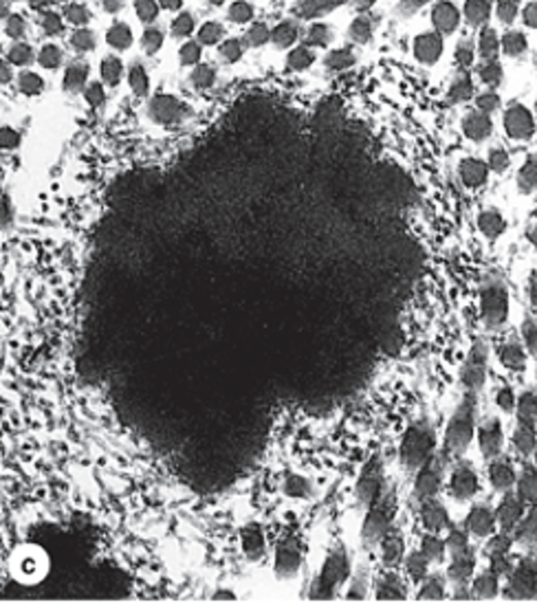 <p>Where does elastin accumulate during elastic fiber formation, and what remains visible on the surface?</p>