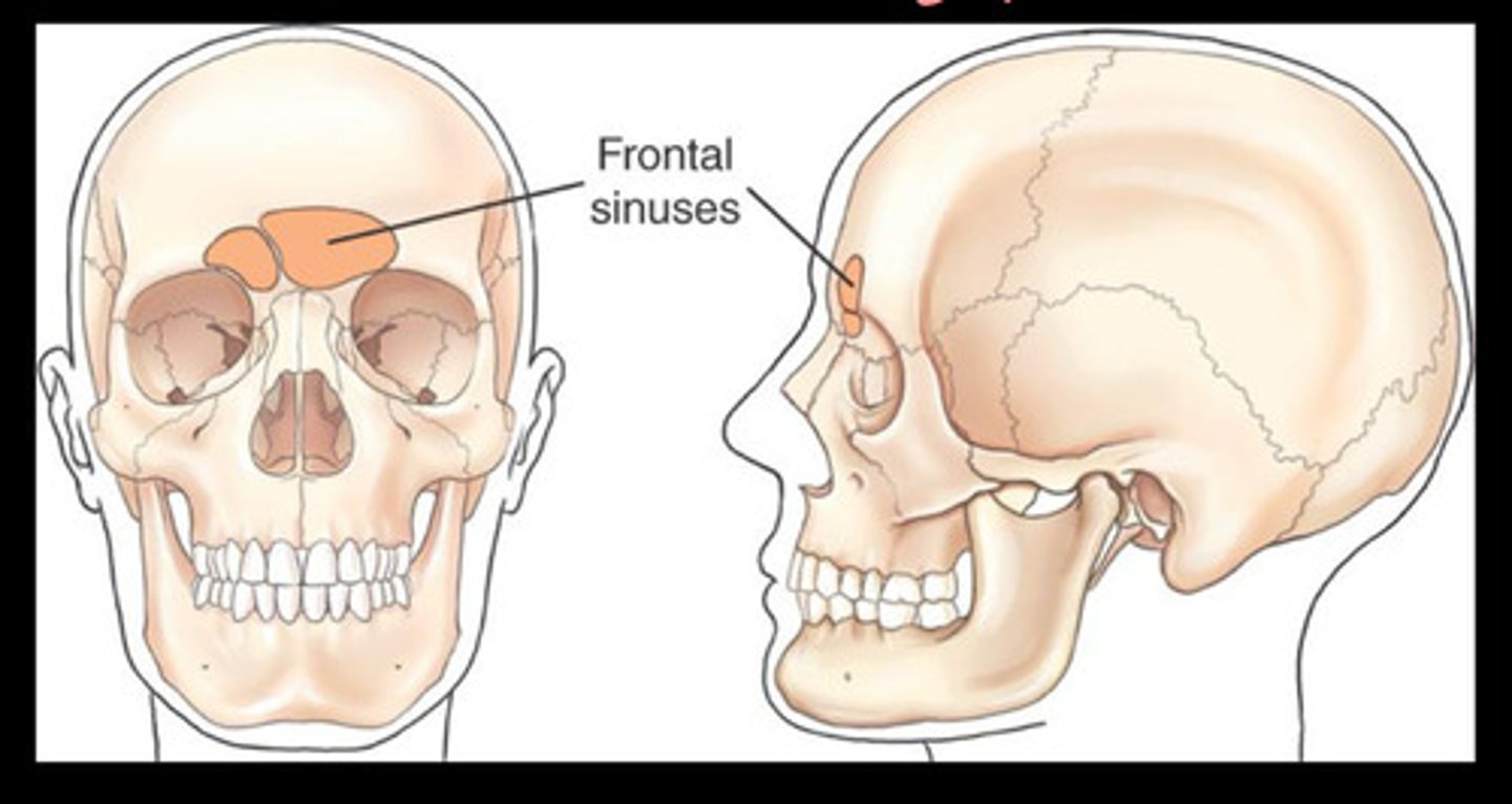 <p>Inner and outer tables of frontal bone</p>