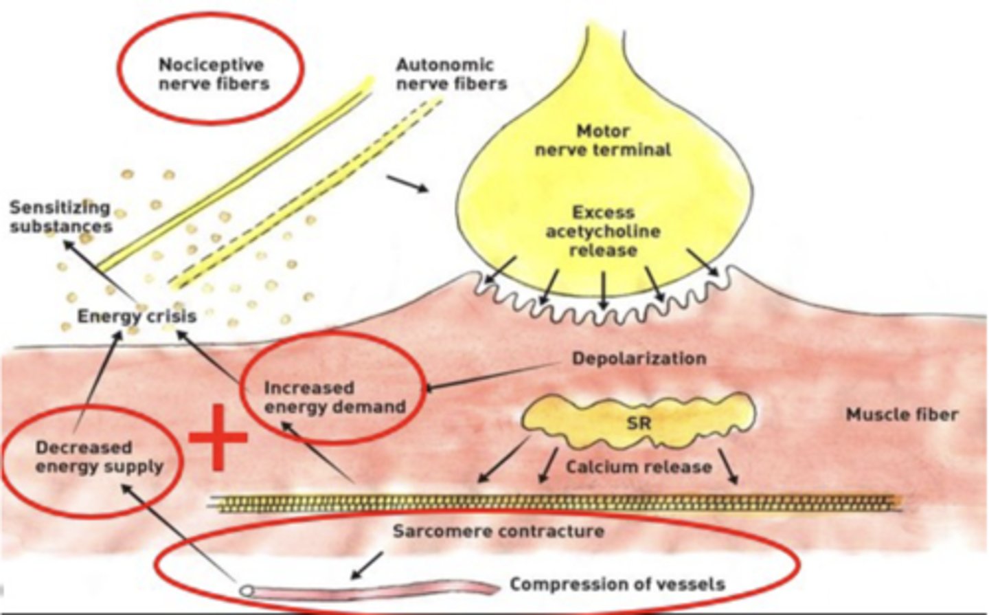 <p>Supply/Demand issue!</p><p>- Increased muscle work = Increased demand</p><p>- Reduces oxygen in and around muscle</p><p>- Activation of nociceptors</p>