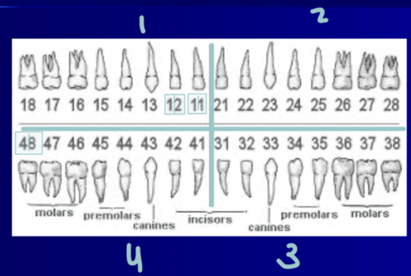 <p>- Uses quadrants 1-4 UR to LR and numbers #1-8 starting at midline</p><p>- Numbers are boxed, first number is the quadrant tooth is in and the second is the number tooth (1-8 starting at midline)</p>
