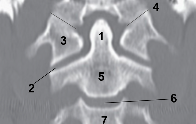 <p>7</p>