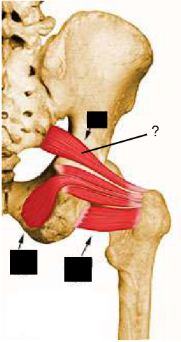 <p>Nom et caractéristiques de cette structure ?</p>