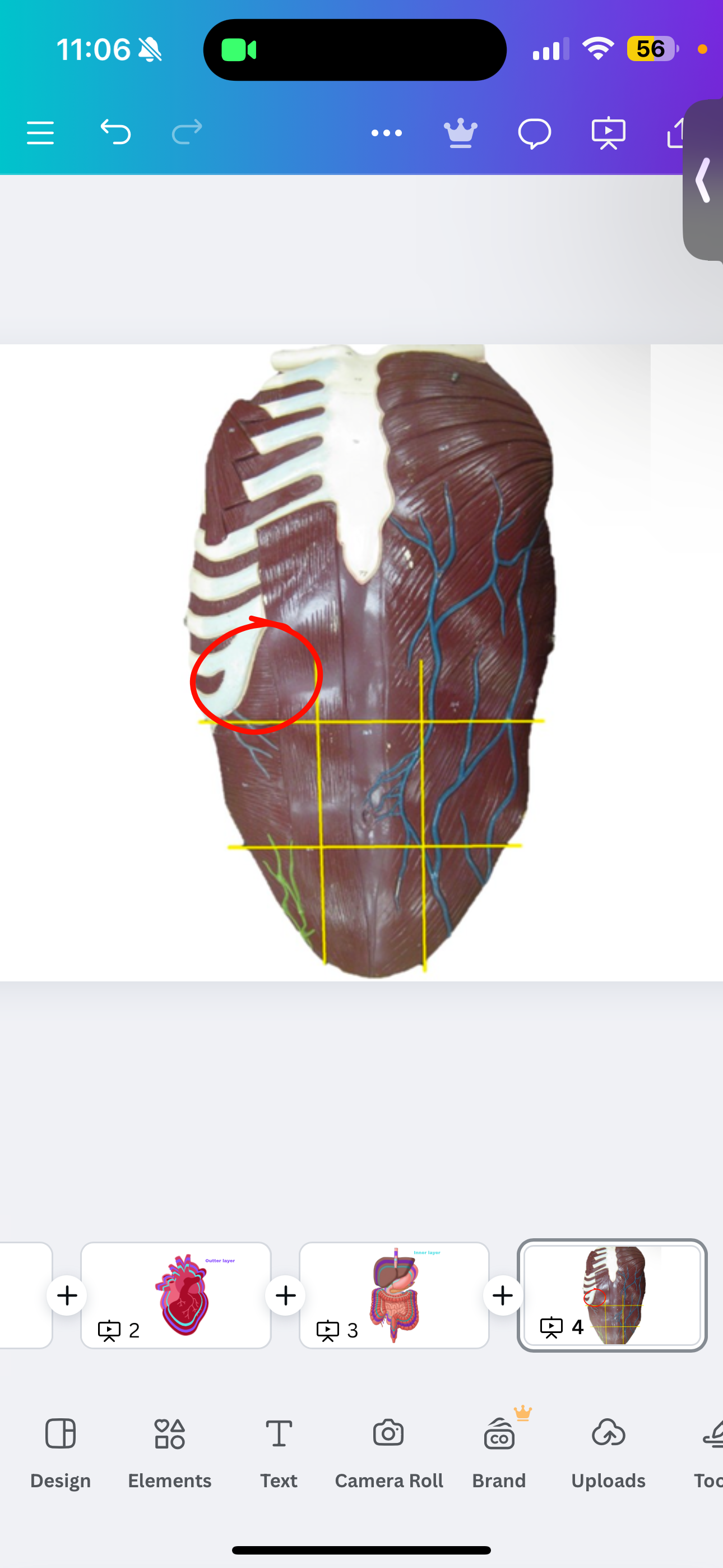 <p>Right hypochondriac region</p>