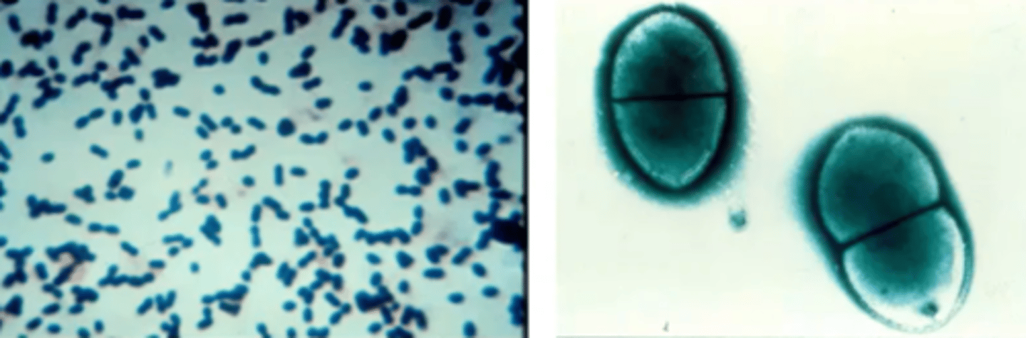 <p>Gram positive diplococci</p><p>-"lancet shape"</p><p>-elderly people and babies</p><p>Sample from</p><p>-blood</p><p>-rust colored sputum</p><p>-CNS fluid</p><p>*NOT throat swab</p>