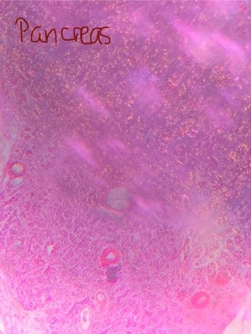 <p>Identify this slide.</p>