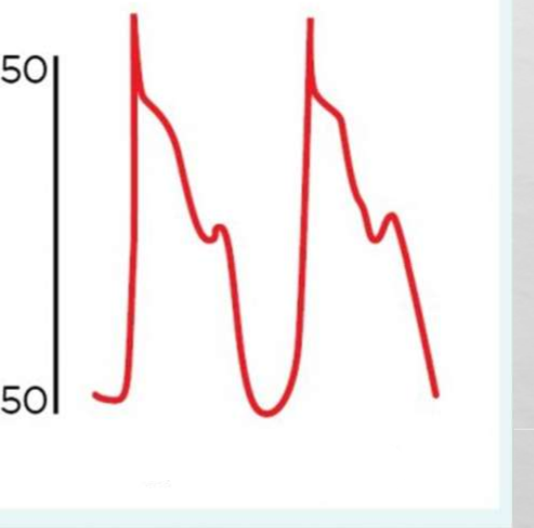 <p>Whats occurring in this </p>