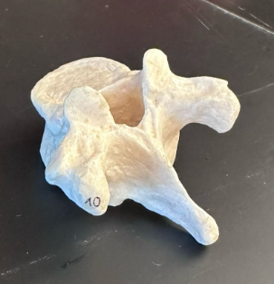 <p>What is this bone?</p>