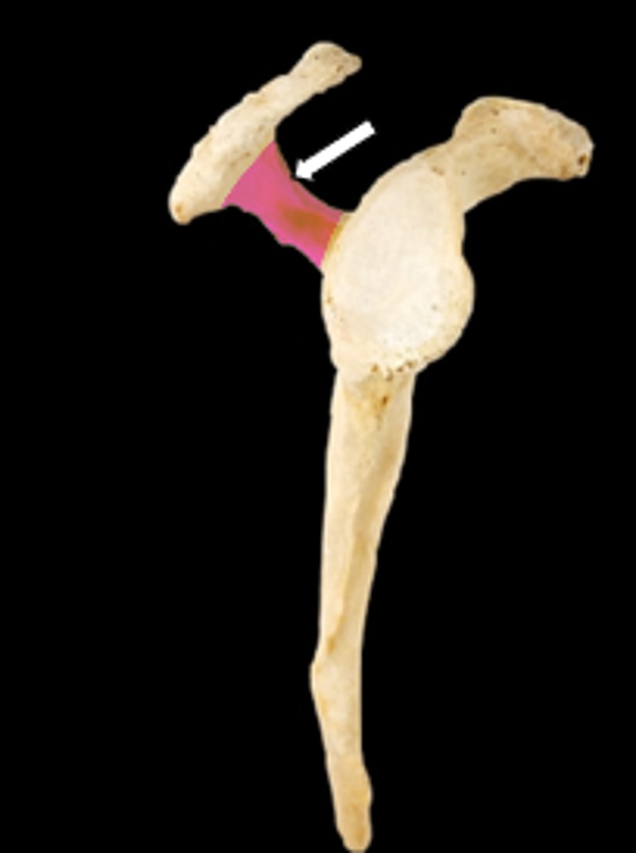 <p>name the part</p>